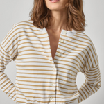 Woman wearing a yellow and white striped shirt against a plain background